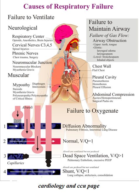 Respiratory Failure Mental Tips, Acute Respiratory Failure, Respiratory Failure, Emt Study, Paramedic School, Heart Lungs, Nursing Information, Nursing Diagnosis, Nursing Mnemonics