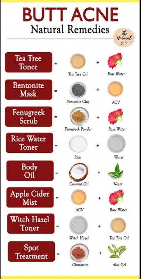 3 Best Remedies For Back Acne https://overdoseofhealth.com/3-best-remedies-for-back-acne/ https://overdoseofhealth.com/3-best-remedies-for-back-acne/ Remedies For Back Acne, Natural Remedies For Acne, Back Acne Remedies, Tea Tree Toner, Cystic Acne Remedies, Remedies For Acne, Back Acne, Witch Hazel Toner, Bad Acne