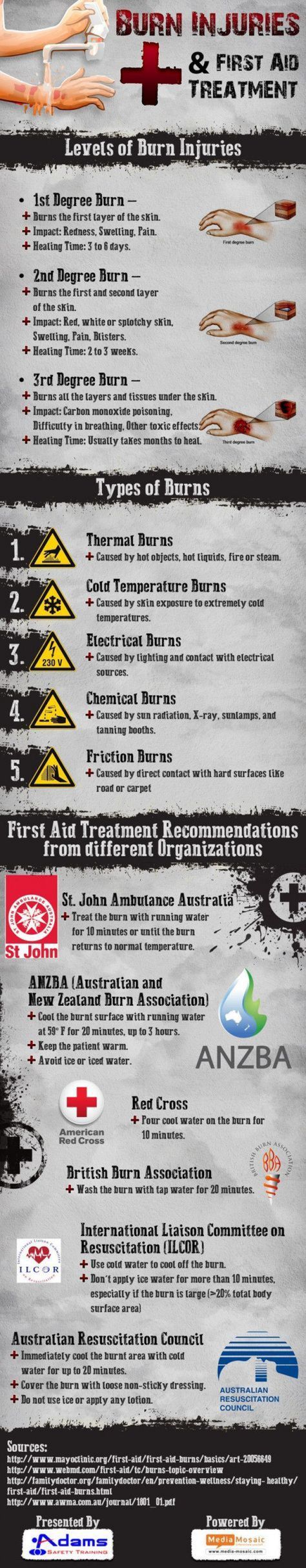 Burn injuries are the most common household & work sites injuries. This Infographic is about ?#?firstaid? procedures for burn injuries recommended by health & safety training providers. #firstaid #first #aid #station Types Of Burns, First Aid Training, Burn Injury, First Aid Tips, Emergency First Aid, Emergency Care, Safety Training, Medical Knowledge, Emergency Prepping