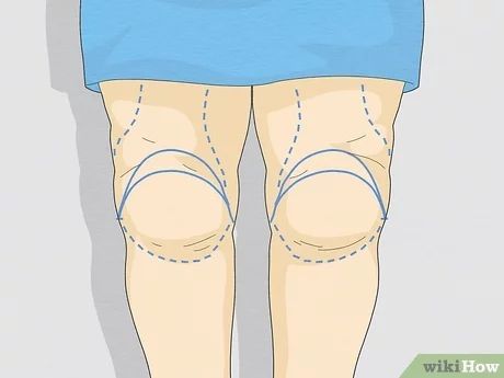 How To Slim Down Your Knees, Knee Fat Exercises Inner, Slimmer Knee Workout, Fat Legs How To Get Rid Of, Tone Knees, How To Get Rid Of Thigh Dimples, Fatty Knees Get Rid Of, Saggy Knees Workout, Knee Fat Exercises Get Rid Of