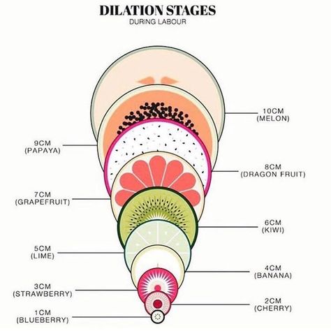 Creative way to learn about dilation stages during labour. @pregnancy.advice . The birth of your child is a special and unique experience.… D Pharmacy, Duvet Day, Pharmacy School, Water Birth, Pregnancy Advice, Medical Facts, Obstetrics And Gynaecology, Medical Anatomy, Medical Art