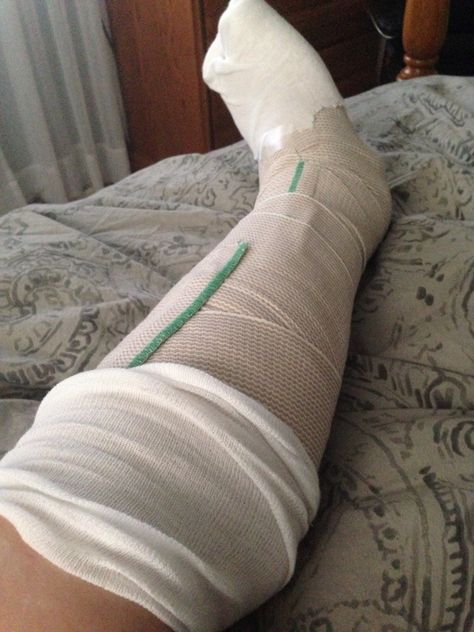 Broke Leg Snapchat, Burned Hand Pic, Leg Broken, Hands With Drip In Hospital, Clear Glasses Frames Women, Medical Boot, Best Love Photos, Fake Photo Sick, Hip Brace