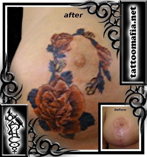 Breast Reduction Tattoo Cover Up, Scar Cover Up Tattoo, Covering Tattoos, Mastectomy Scar Tattoo, Mastectomy Scars, Mastectomy Tattoo, Scar Cover Up, Scar Tattoo, Breast Reconstruction