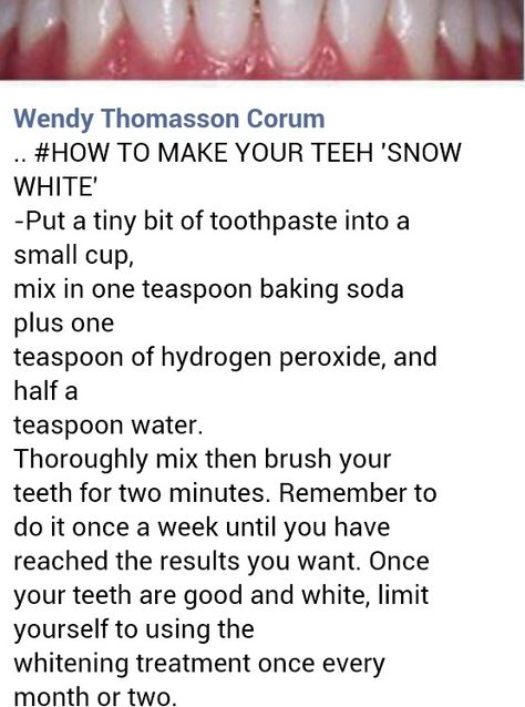 Baking Soda Teeth, Baking Soda Teeth Whitening, Teeth Whitening Homemade, Teeth Whitening Remedies, Teeth Whitening Diy, Teeth Health, Home Health Remedies, Natural Teeth Whitening, Whitening Toothpaste