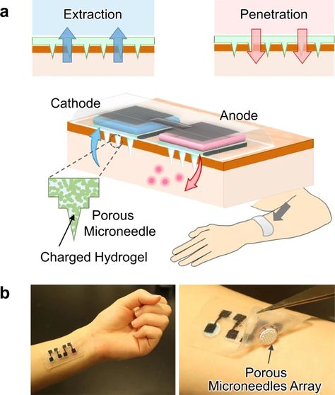 Transdermal electroosmotic flow generated by a porous microneedle array patch | Nature Communications Transdermal Patch, Skin Patches, Google Scholar, Ministry Of Education, Pig Skin, Skin Barrier, Graduate School, Nature