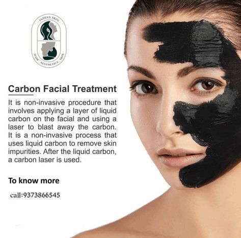 Carbon Laser Facial, Hollywood Peel, Carbon Facial, Facial Before And After, Carbon Peel, Carbon Laser, Facial Benefits, Hair Laser, Laser Peel