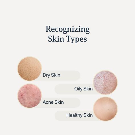 Based on the images, tell us what your skin type is? Do you need help with identifying? Comment Skin Type and we’ll personally help you walk through your skin type and find the best products for you. Comment below 👇🏽 English Presentation, Bridal Skin, Bridal Skin Care, Skin Prep, Skin Type, Best Products, Do You Need, Natural Skin, Natural Skin Care