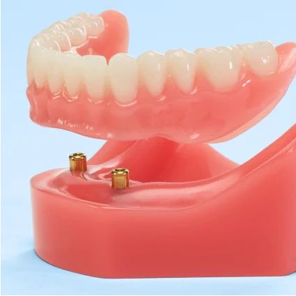 Dentures with Same Day Denture Replacements and Repairs Paintless Dent Repair, Fixed Partial Denture, Complete Denture Before And After, Permanent Dentures, Denture Adhesives, Complete Denture, Aspen Dental, Removable Partial Denture, Denture Cleaner