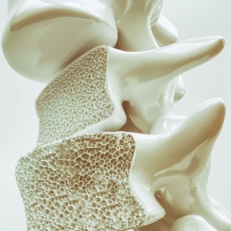 Osteoporosis Symptoms, Bone Density Test, Low Bone Density, Hip Fracture, Sistem Pencernaan, Weight Bearing Exercises, Bone Fracture, Bone Diseases, Bone Strength