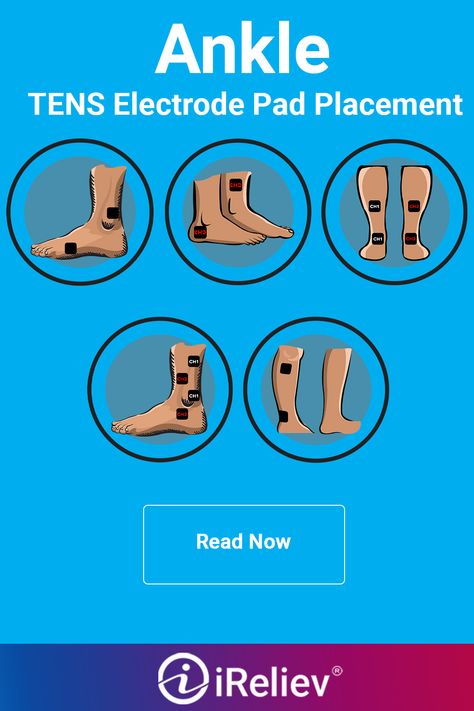 In order to achieve the best results from your iReliev device, you should follow proper TENS muscle stimulation pad placement pictographic. Tens Electrode Placement, Tens Unit Placement, Tens Machine, Tens Ems, Ten Unit, Muscle Stimulator, Restless Leg Syndrome, Leg Cramps, Physical Therapy Exercises