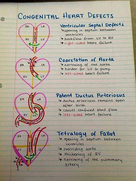 Nursing Student Tips, Congenital Heart Defect, Cardiac Nursing, Heart Defect, Nursing School Survival, Congenital Heart, Best Nursing Schools, Nursing School Studying, Nursing School Tips