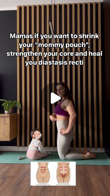 Mom Pouch, Healing Exercises, Muscle Separation, 5 Fingers, Mom Bod, My Core, Postpartum Body, Diastasis Recti, Post Partum Workout