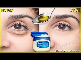 Eye Wrinkles Remedies, Face Wrinkles Remedies, Puffy Eyes Remedy, Wrinkles Remedies Face, Eye Bags Treatment, Wrinkle Remedies, Flot Makeup, Eyes Dark, Natural Face Skin Care