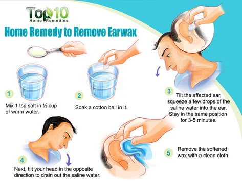 Ear Wax Buildup, Saline Water, Dry Skin Routine, Top 10 Home Remedies, Morning Workouts, Cleaning Your Ears, Ear Wax Removal, Ear Cleaning, Ear Wax