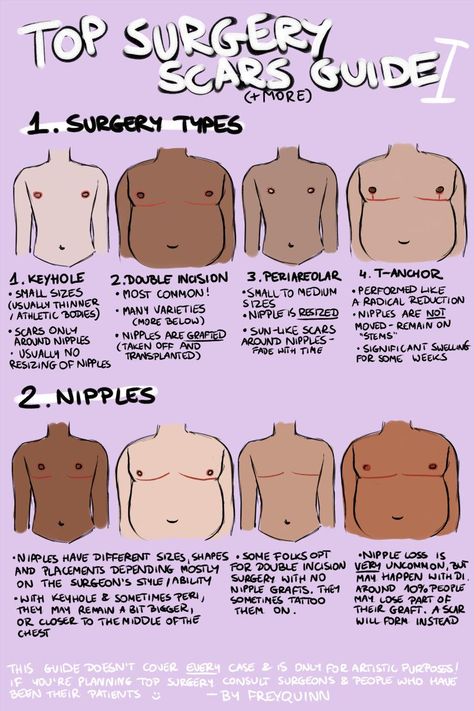 n. frey @ commissions open • B.L.M on Twitter: "TOP SURGERY scars(+more) guide ✨ i have seen very few guides on drawing chests that have undergone top surgery & the few i've seen were very flawed, so now that i've recovered from my own surgery i decided to draw my own! this may have more parts if i remember more stuff!… https://t.co/LA0pAo1PfE" Top Surgery Scars, Top Surgery, Trans Art, Trans Boys, Tweek Y Craig, Losing 40 Pounds, Trans Pride, Happier Life, Lose 40 Pounds