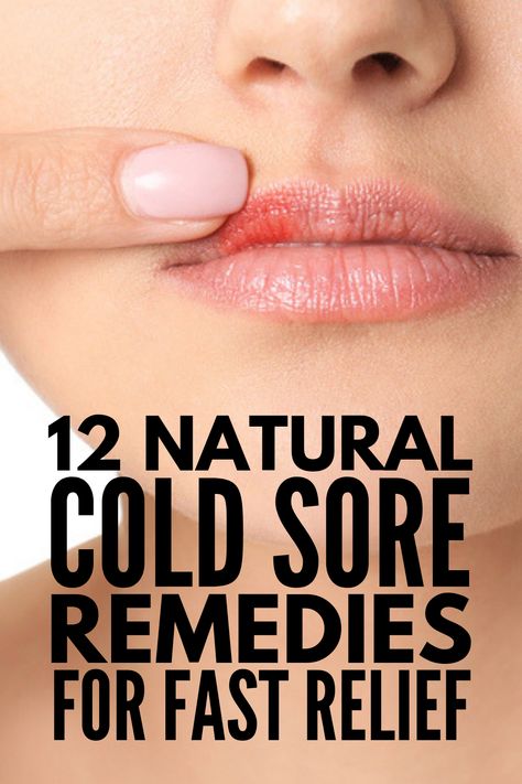 Blister Remedies, Cold Sore Remedies, Blister On Lip, Natural Cold Sore Remedy, Fever Blister, Cold Sores Remedies, Brown Spots On Face, Spots On Face, Winter Makeup