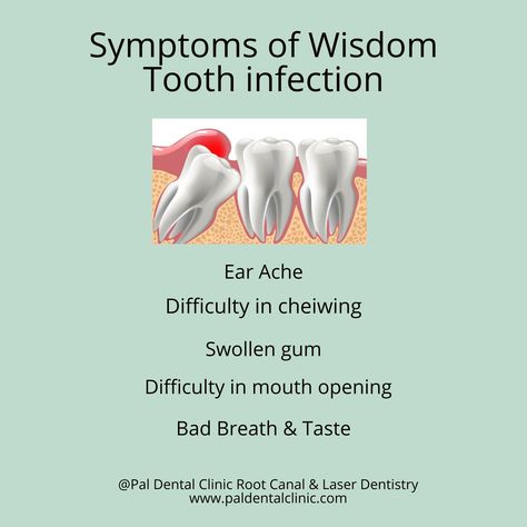 Wisdom teeth, the third molars at the back of the mouth are the last adult teeth to come in. Impacted wisdom teeth can cause pain, damage other teeth and lead to other dental problems (listed above)usually are taken out. Impacted Wisdom Teeth, Ear Ache, Laser Dentistry, Swollen Gum, Dental Problems, Wisdom Teeth, Root Canal, Alia Bhatt, Dental Clinic