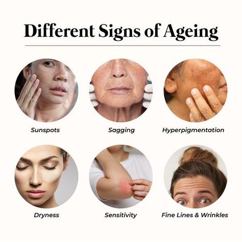 Medicine Knowledge, Esthetician Life, Best Wrinkle Cream, Moisturizer For All Skin Types, Skin Anatomy, Best Spf, Kris Exo, Skincare Advice, Skin Facts