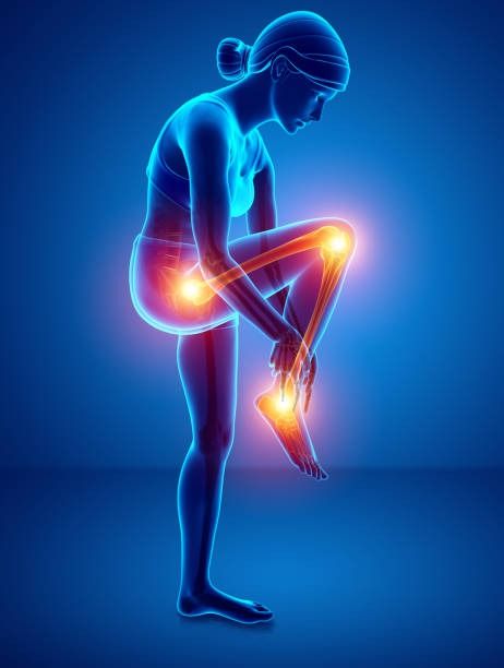 6,305 Knee Pain Stock Photos, Pictures & Royalty-Free Images - iStock Crps Awareness, Complex Regional Pain Syndrome, Sciatica Pain Relief, Foot Injury, Leg Cramps, Work Images, Sciatica Pain, Leg Pain, Autoimmune Disorder