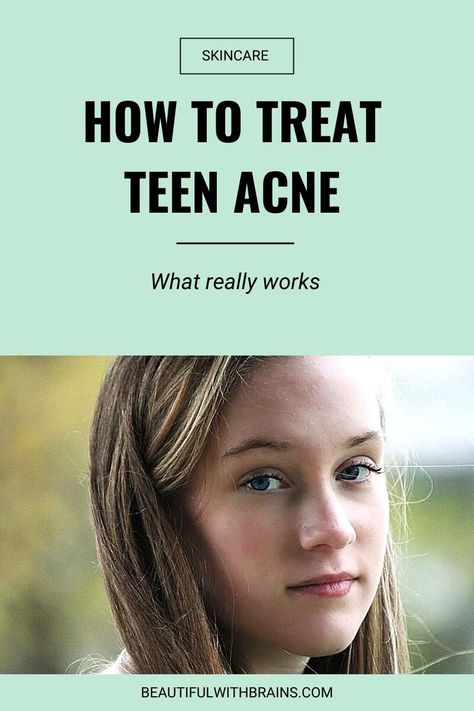 Teenage Acne, Face Mapping Acne, Forehead Acne, Acne Prone Skin Care, Teen Skincare, Bad Acne, Acne Skincare Routine, Natural Acne Remedies, Acne Scar Removal