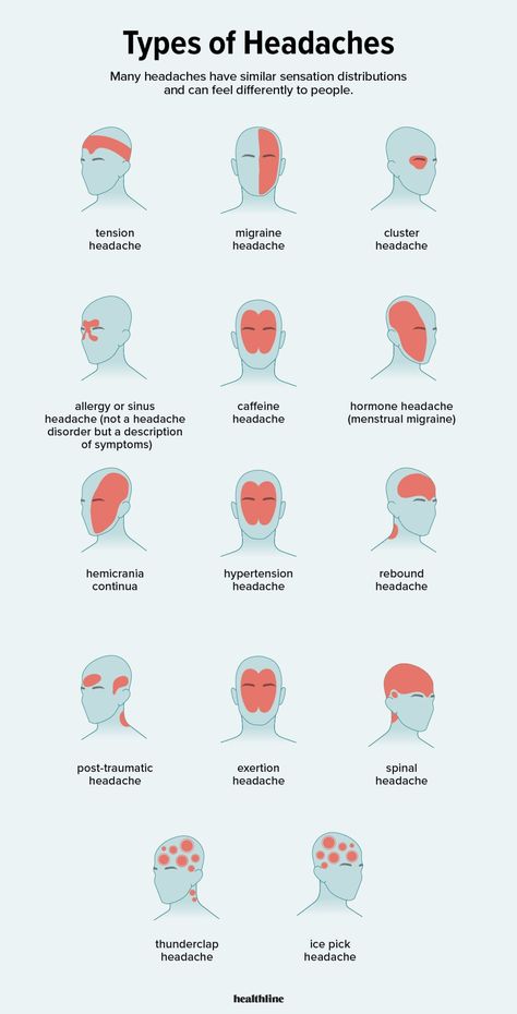 Headache Types, Migraine Headaches, Medical Knowledge, Alam Semula Jadi, Health Info, Health And Beauty Tips, Health Facts, Home Health, Useful Life Hacks