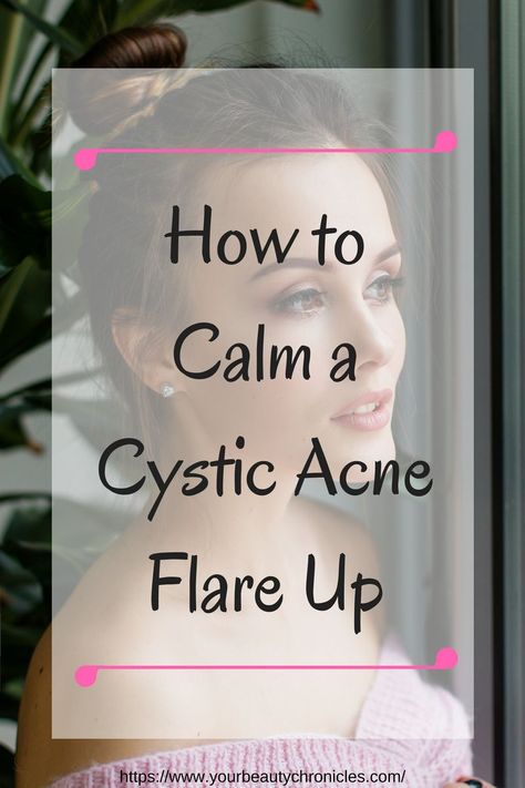 Healthy Nails Remedies Acne On Nose, Cystic Acne On Chin, Nodule Acne, Treating Cystic Acne, Cystic Pimple, Cystic Acne Remedies, Cream Tattoo, Blind Pimple, Natural Acne Remedies