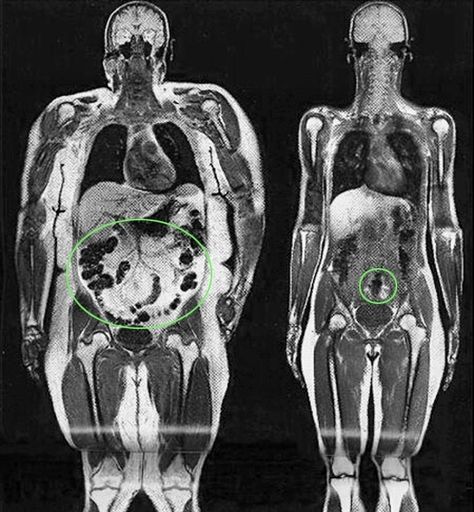 Big Boned, Human Body Anatomy, Human Anatomy Art, Medical Anatomy, Body Anatomy, Diet Motivation, Medical Illustration, Anatomy Reference, Anatomy And Physiology