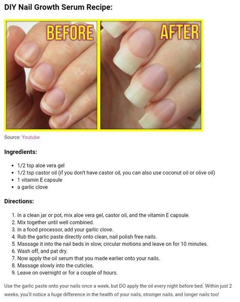 Nail Growth Tips, Nagellack Trends, How To Grow Nails, Nail Growth, Growth Serum, Manicure Y Pedicure, Healthy Nails, Beauty Skin Care Routine, Body Skin Care