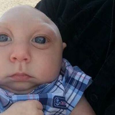 "Normal Babies Look Weird to Us" Blue Eyes, Blue, White