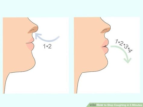 How to Stop Coughing in 5 Minutes: Tips for Immediate Relief How To Stop Coughing Immediately, Home Remedies For Fleas, Home Remedies For Bronchitis, Remedies For Glowing Skin, How To Stop Coughing, Athletes Foot, Tooth Extraction, Home Remedies For Acne, Home Remedy For Cough