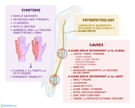 Ulnar Nerve Exercises, Cubital Tunnel Syndrome, Nerve Conduction Study, Ulnar Nerve, Basic Anatomy And Physiology, Peripheral Nerve, Muscular System, Medical School Essentials, Muscle Anatomy