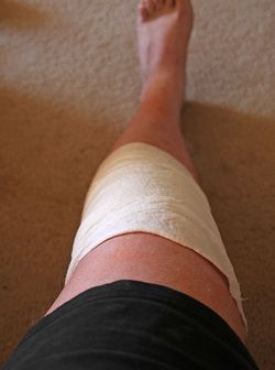 Bandaged knee after total knee replacement Knee Replacement Pain, Knee Anatomy, Knee Replacement Surgery Recovery, Stiff Knee, Knee Replacement Exercises, Knee Replacement Recovery, Knee Surgery Recovery, Knee Pain Relief Exercises, Bad Knee Workout