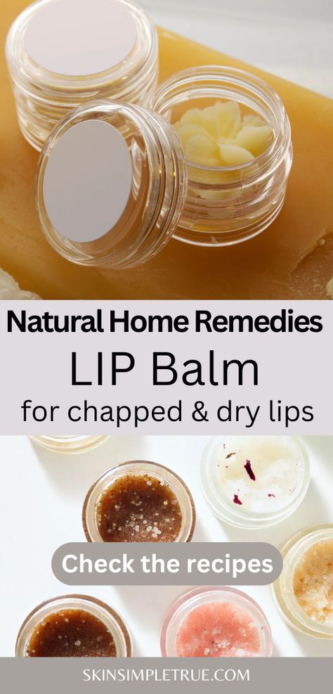 dry chapped lips remedy DIY Diy Natural Lip Balm Recipes, Best Homemade Lip Balm, Homemade Lip Mask Recipe, Lip Balm Recipes Homemade, Chapped Lips Remedy Severe, Lip Sugar Scrub Diy, Diy Chapstick Recipe, How To Make Lip Balm At Home, How To Make Lip Balm