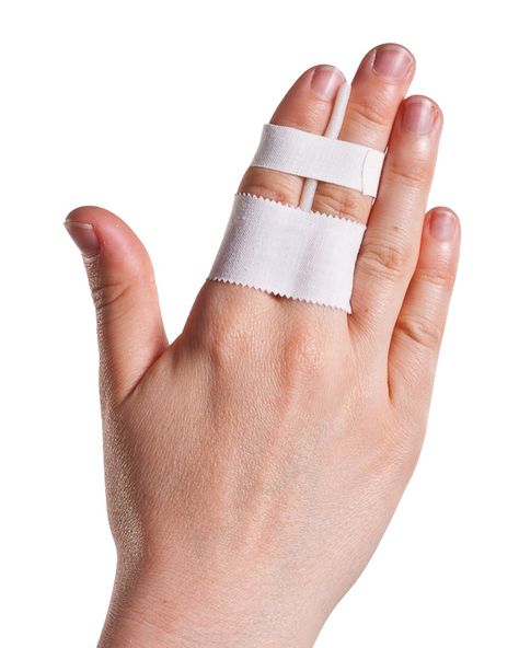 Fractured Finger, Athletic Training Sports Medicine, Faraday Cage, Rugby Training, First Aid Tips, Sports Therapy, Orthopedic Surgeon, Sports Tape, Medical Training