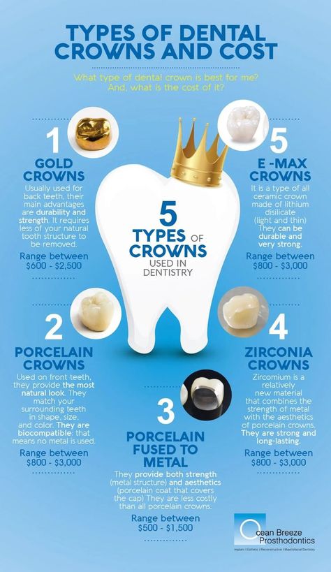 Types Of Crowns, Dental Assistant Study Guide, Dental Assistant School, Dental Hygienist School, Dental Assistant Study, Dentist Assistant, Dental Hygiene Student, Dental World, Dental Posts