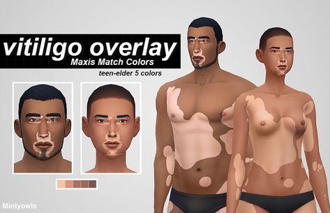 VITILIGO OVERLAY A vitiligo overlay for your sims in five maxis match colors, two lighter tones for paler sims, and three darker tones for darker sims. This is for male and female sims teen-elder... Female Sims, Tattoo Neck, Sims Stories, Sims 4 Traits, The Sims 4 Skin, Pelo Sims, Sims 4 Mm Cc, Sims 4 Cc Skin, Sims 4 Mm