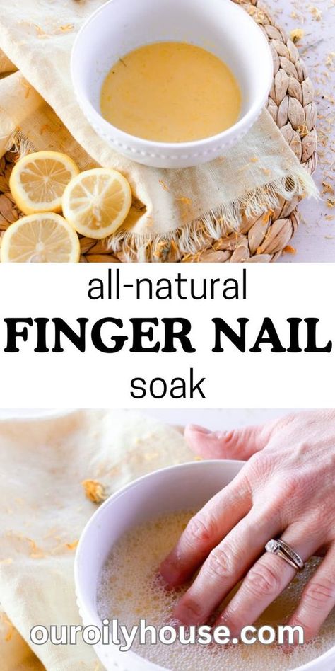 How to Strengthen Nails Naturally at Home? Cute Nails Black, Gel Nail Art Ideas, Natural House Cleaners, Nail Tricks, Hand Soak, Nail Growth Tips, Grow Nails Faster, Fall Nail Inspo, Fast Nail