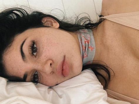 The Freckled Beauty Kylie Jenner, A Woman, White