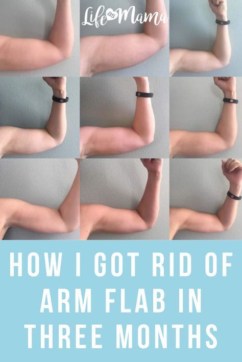 Fitness Before After, Arm Flab, Arm Toning Exercises, Lose Arm Fat, Flabby Arms, Health Fitness Inspiration, Trening Fitness, Get Toned, Toned Arms