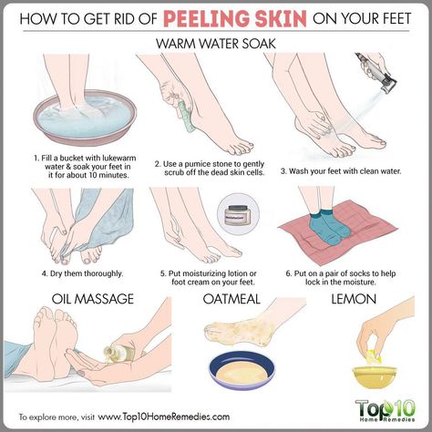 Here are some tips and remedies on how to get rid of peeling skin on feet with exfoliation and foot masks to relieve dryness. Combination Skin Type, Peeling Skin, Dry Skin Care, Skin Care Steps, Oily Skin Care, Skin Remedies, Organic Skin, Homemade Skin Care, Skin Care Women