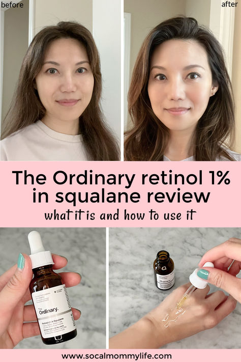 Transform your skincare routine with stunning results! Discover the power of retinol before and after with this game-changing retinol serum from The Ordinary. Perfect for beginners, this beauty essential offers incredible benefits for your skin. Say hello to a radiant and youthful complexion! The Ordinary Skincare Retinol, Retinol 1% In Squalane, Ordinary Retinol Before And After, Before And After Retinol, The Ordinary Retinol 1% In Squalane, Retinol Before And After, Retinol For Beginners, Ordinary Retinol, Retinol For Acne