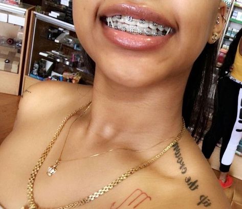 Follow: T I N Y Y for more Silver Braces, Braces Smile, Black Braces, Cute Braces Colors, Pretty Teeth, Braces Tips, Getting Braces, Braces Girls