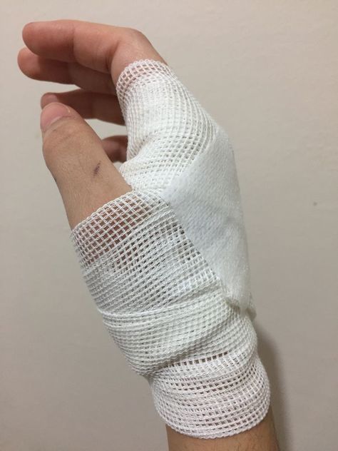 Bandaged Hands, Fake Injury, Funny Airport Signs, Hospital Admit Hand Pics, Corps Idéal, Airport Signs, Beautiful Wallpapers For Iphone, Army Girlfriend Pictures, Artsy Pictures