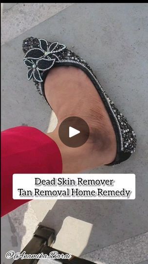 Tan Removal Home Remedies, Feet Whitening, Tan Removal, Dead Skin, Tanning, Home Remedies, Natural Remedies, Skin, Beauty