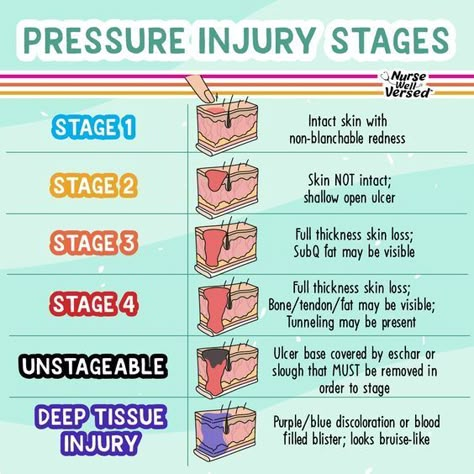 Pressure Injury, Nursing School Studying Cheat Sheets, Wound Care Nursing, Nursing School Life, Nursing School Inspiration, Nursing Cheat, Nursing School Essential, Nurse Study, Nursing Student Tips