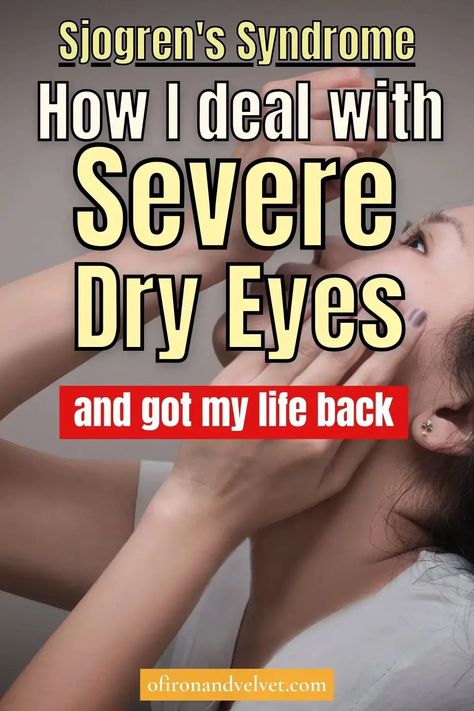 I Have Sjogren’s Syndrome And This Is How I Deal With Severe Dry Eyes - Of Iron and Velvet Dry Eye Remedies, Eye Health Remedies, Remedies For Dry Mouth, Chronic Dry Eye, Home Remedies For Warts, Dry Eye Symptoms, Dry Eyes Relief, Natural Remedies For Migraines, Sunburn Relief