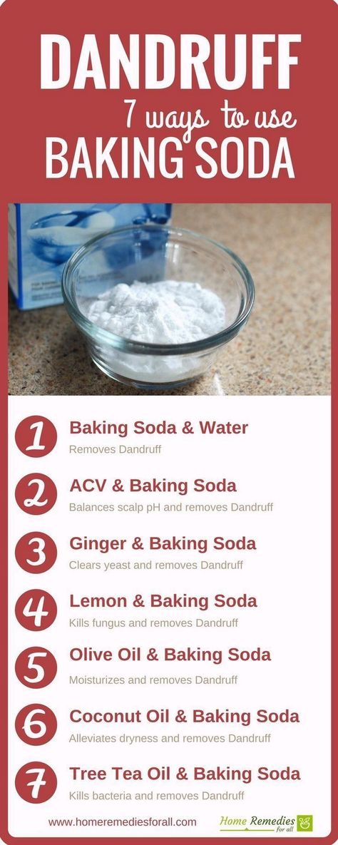 Youtube Remove Dandruff Home Remedies, Baking Powder For Cleaning, Benefits Of Baking Soda, Natural Odor Remover, Baking Soda For Dandruff, Baking Soda Health, Home Remedies For Dandruff, Baking Soda Shampoo Recipe, Baking With Coconut Oil