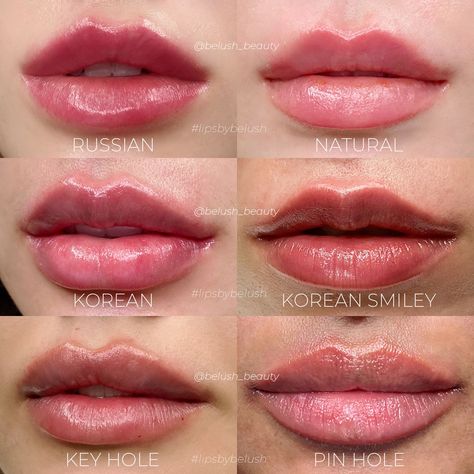 Lip Surgery, Lips Inspiration, Korean Lips, Lip Augmentation, Numbing Cream, Lip Filler, Full Lips, Lip Shapes, Cosmetic Treatments