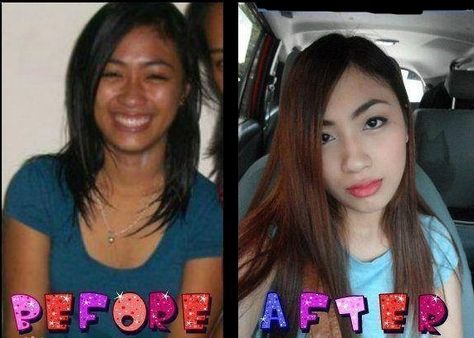 Glutathione Before And After, Dry Skin Makeup, Dry Skin Problem, Before And After Pics, Diy Anti Aging, Anti Aging Supplements, Anti Aging Tips, Moisturizer With Spf, Skin Care Recipes