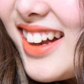 Rabbit Teeth Girl Smile, Rabbit Teeth Smile, Bunny Teeth Smile Girl, Teeth Claims For Dr, Bunny Teeth Aesthetic, Teeth Claim, Bunny Teeth Smile, Rabbit Teeth, Cute Teeth